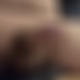 photo de HomoErectile