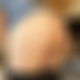 photo de erozen
