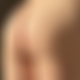photo de erozen