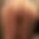 photo de spiderma3
