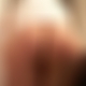 photo de spiderma3