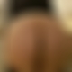 photo de spiderma3