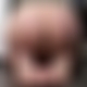 photo de spiderma3