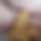 photo de accrobite