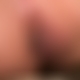 photo de radiacoquine
