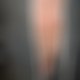 photo de foreskin