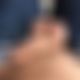 photo de burnedistendu