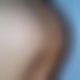 photo de anus